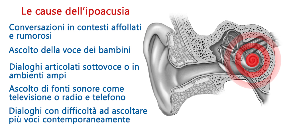 ipoacusia-le-cause-i-rimedi-punto-acustico-due