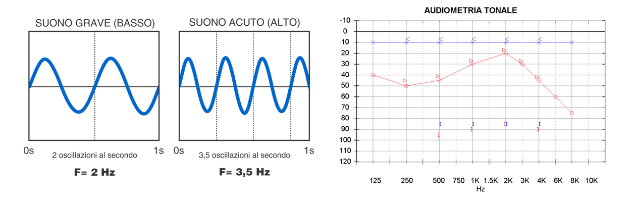 test udito e controlli apparecchi acustici punto acustico due